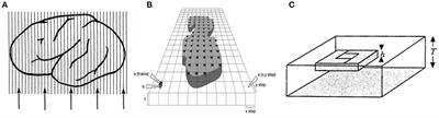 Using the Optical Fractionator to Estimate Total Cell Numbers in the Normal and Abnormal Developing Human Forebrain